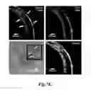 Fig. 12 - NANOFIBROUS CONDUITS FOR NERVE REGENERATION