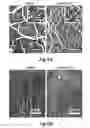 Fig. 15 - NANOFIBROUS CONDUITS FOR NERVE REGENERATION