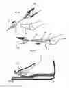Fig. 06 - Method and apparatus for preparing and fusion of small joints