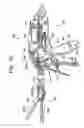 Fig. 06 - Methods and devices for controlling motorized surgical devices