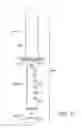 Fig. 08 - Magnetic vaginal dilator