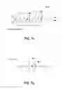 Fig. 08 - Method for stabilizing a spine
