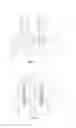Fig. 02 - Method of Positioning Pedicle Screws and Spinal Rods and Apparatuses for the Same
