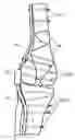 Fig. 01 - KNEE BRACE FIXATION APPARATUS AND METHOD FOR APPLICATION THEREOF