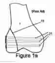 Fig. 02 - KNEE BRACE FIXATION APPARATUS AND METHOD FOR APPLICATION THEREOF