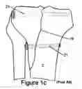 Fig. 04 - KNEE BRACE FIXATION APPARATUS AND METHOD FOR APPLICATION THEREOF