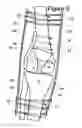 Fig. 07 - KNEE BRACE FIXATION APPARATUS AND METHOD FOR APPLICATION THEREOF