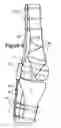 Fig. 08 - KNEE BRACE FIXATION APPARATUS AND METHOD FOR APPLICATION THEREOF