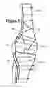 Fig. 09 - KNEE BRACE FIXATION APPARATUS AND METHOD FOR APPLICATION THEREOF