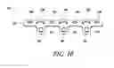 Fig. 06 - Method and device for correcting bone deformities