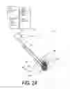 Fig. 03 - Bone treatment systems and methods