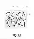 Fig. 09 - Bone treatment systems and methods