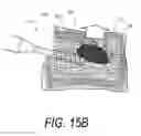 Fig. 22 - Bone treatment systems and methods