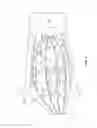 Fig. 05 - Balloon catheter with flexible electrode assemblies