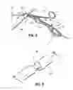 Fig. 07 - Vessel sealing forceps
