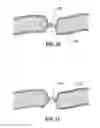 Fig. 08 - Vessel sealing forceps