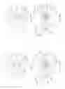 Fig. 04 - Surgical device having changeable elements