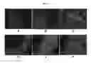 Fig. 06 - Engineered three-dimensional breast tissue, adipose tissue, and tumor disease model