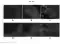Fig. 07 - Engineered three-dimensional breast tissue, adipose tissue, and tumor disease model