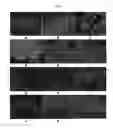 Fig. 09 - Engineered three-dimensional breast tissue, adipose tissue, and tumor disease model