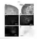 Fig. 20 - Engineered three-dimensional breast tissue, adipose tissue, and tumor disease model