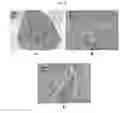 Fig. 28 - Engineered three-dimensional breast tissue, adipose tissue, and tumor disease model