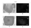 Fig. 30 - Engineered three-dimensional breast tissue, adipose tissue, and tumor disease model