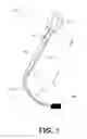 Fig. 02 - Adjustable loop fiber optic illumination device for surgery