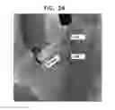 Fig. 24 - Automatic reduction of visibility of portions of an image