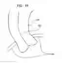Fig. 22 - Identification and presentation of device-to-vessel relative motion