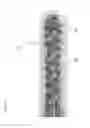 Fig. 06 - DRILL AND TAP AND METHOD FOR PREOPERATIVE ASSESSMENT OF BONE QUALITY