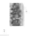 Fig. 07 - DRILL AND TAP AND METHOD FOR PREOPERATIVE ASSESSMENT OF BONE QUALITY