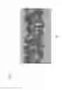 Fig. 08 - DRILL AND TAP AND METHOD FOR PREOPERATIVE ASSESSMENT OF BONE QUALITY