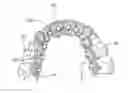 Fig. 01 - Method for producing a customized orthodontic appliance