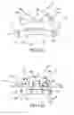 Fig. 07 - Method for producing a customized orthodontic appliance