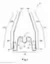 Fig. 02 - Apparatus for applying corrective forces to shape palate