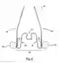 Fig. 06 - Apparatus for applying corrective forces to shape palate