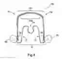 Fig. 07 - Apparatus for applying corrective forces to shape palate