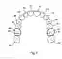 Fig. 08 - Apparatus for applying corrective forces to shape palate