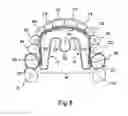 Fig. 09 - Apparatus for applying corrective forces to shape palate