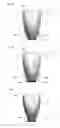 Fig. 06 - Designing a dental restoration