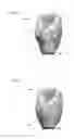 Fig. 09 - Designing a dental restoration