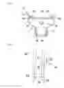 Fig. 09 - Oral cleaning device