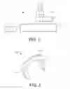 Fig. 02 - Devices and methods for fixation of bodily implants