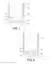 Fig. 05 - Devices and methods for fixation of bodily implants