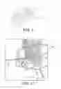 Fig. 07 - Devices and methods for fixation of bodily implants