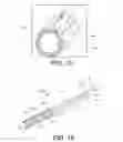 Fig. 10 - Devices and methods for fixation of bodily implants
