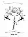 Fig. 13 - Methods and systems for treatment of prolapse