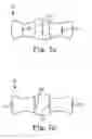 Fig. 07 - Patterned implant and method