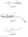 Fig. 10 - Patterned implant and method